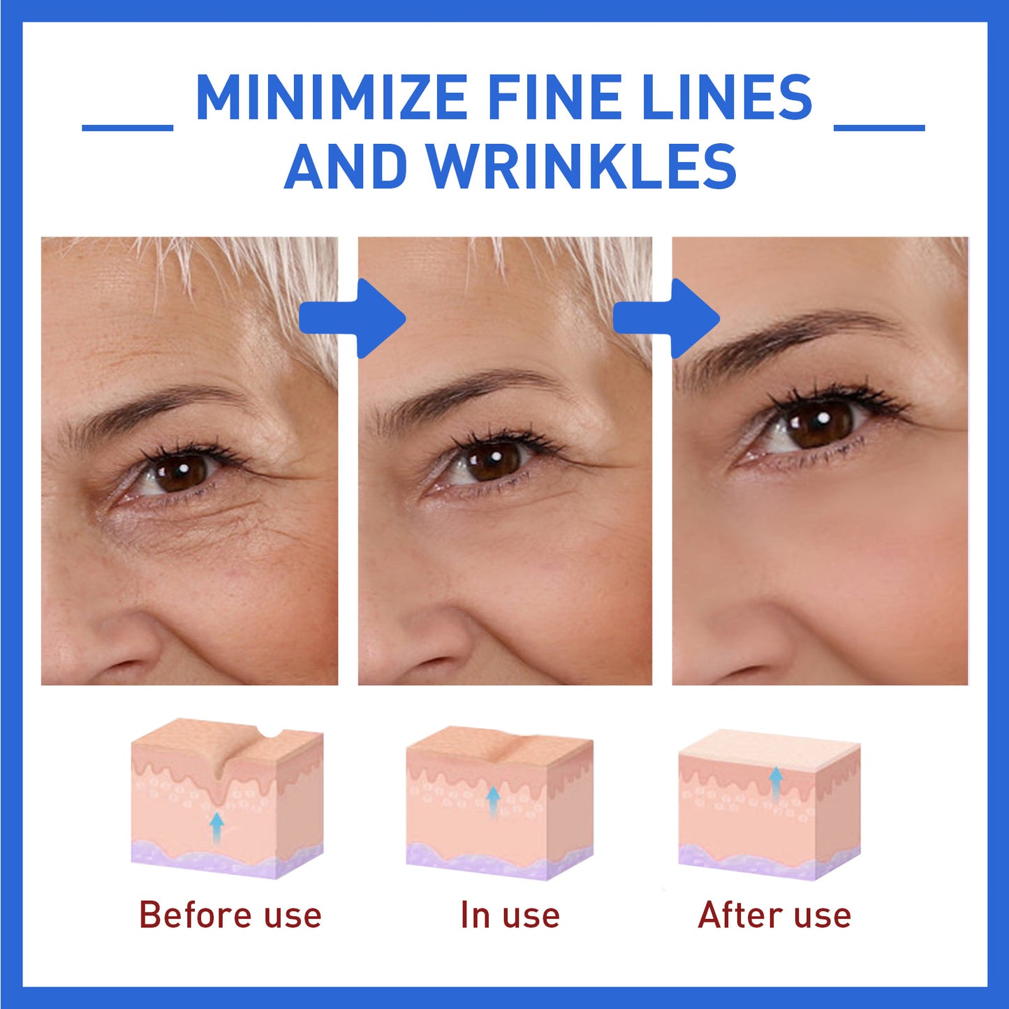 LiftMe™ — Anti-Wrinkle Solution
